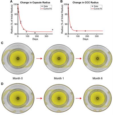 Implantation of a capsular tension ring during cataract surgery attenuates predicted remodeling of the post-surgical lens capsule along the visual axis